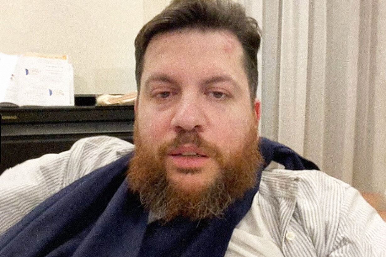 Леонид Волков после нападения
