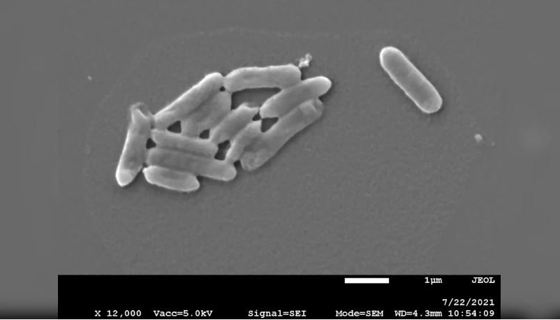 Бактерии-экстремофилы Acidithiobacillus ferrooxidans под микроскопом. Фото © cambridge.org