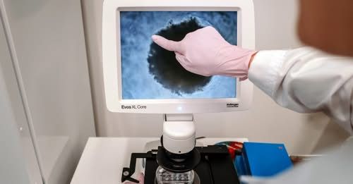 Keystone / Laif Jens Gyarmaty