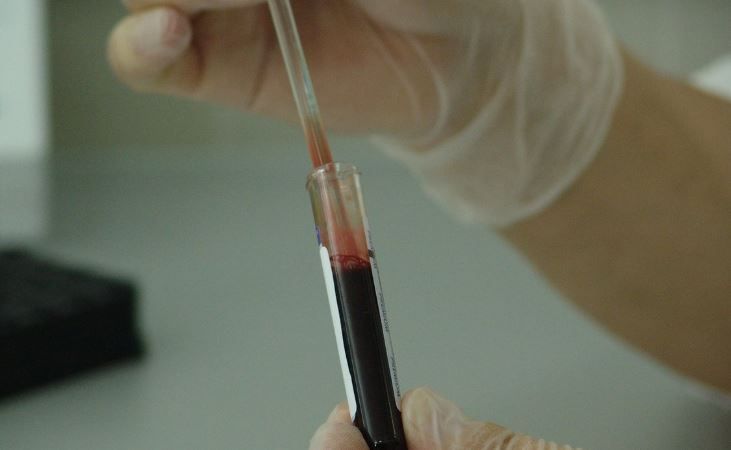 Лаборатория. Иллюстративный снимок ФОТО: pixabay.com