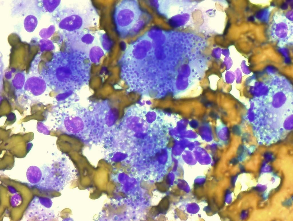 Histoplasma capsulatum. Фото: © Flickr / Yale Rosen