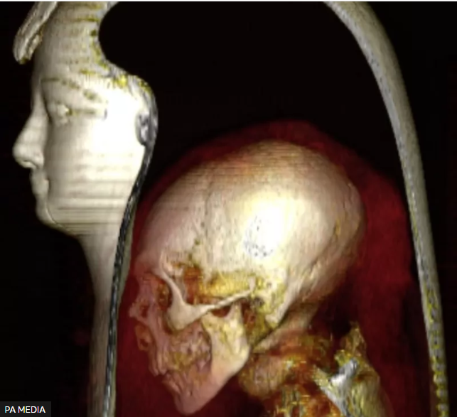 PA MEDIA Подпись к фото, Компьютерная томография позволила изучить мумию, не нарушив целостность покрова тела