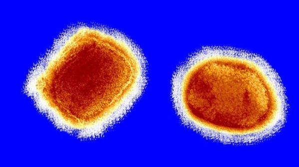 Вирус обезьяньей оспы. Фото: Wikimedia